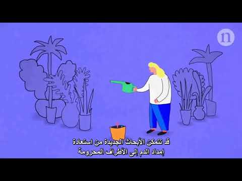 Restoring circulation: Treating critical limb ischaemia استعادة الدوران: علاج إقفار الطرف الحَرِج