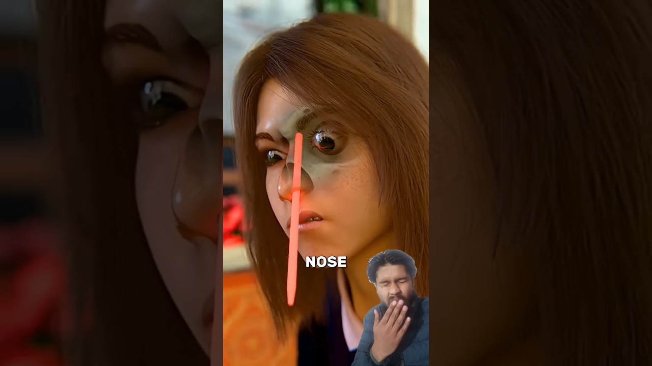 Nose bone fracture mini mistake 😭