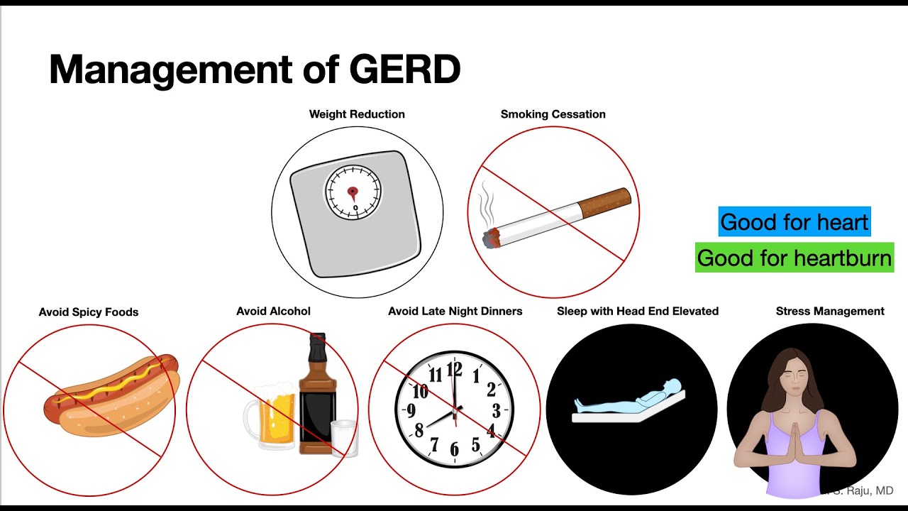 GERD-Management-Life Style Changes