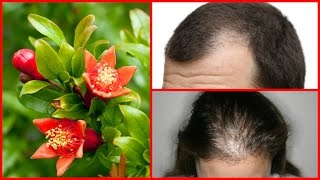 बालों का गंजापन कैसे दूर करें ! बुढ़ापे तक नहीं होंगे गंजे ! गंजापन दूर कैसे करे screenshot 5