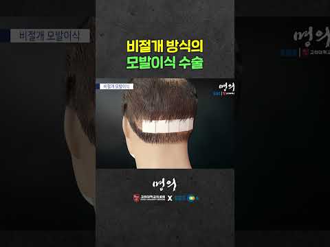 비절개로 진행되는 모발이식 수술 과정