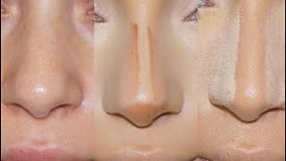 خطوات سهله لكونتور تصغير الأنف باحترافية | how to contour your nose