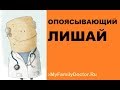 Как лечить опоясывающий лишай