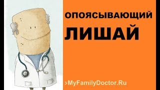 Как лечить опоясывающий лишай