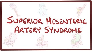 Superior Mesenteric Artery Syndrome An Osmosis Preview Youtube Superior Mesenteric Artery Syndrome An Osmosis Preview Youtube