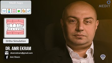 Medit ortho simulation (Arabic tutorial)