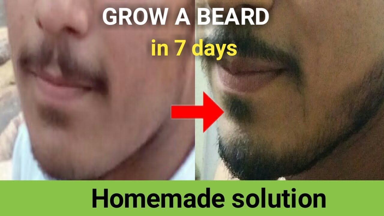 Grow your beard in 7 days 
