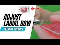 How to Adjust a Labial Bow in a Hawley, Close a Space, Retract Overjet