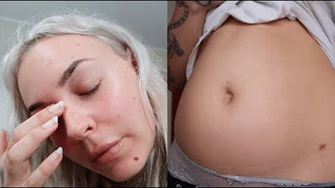 Health Update