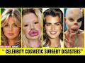 35 Celebrity Plastic Surgery Disasters – You’d Never Recognize Them Today!