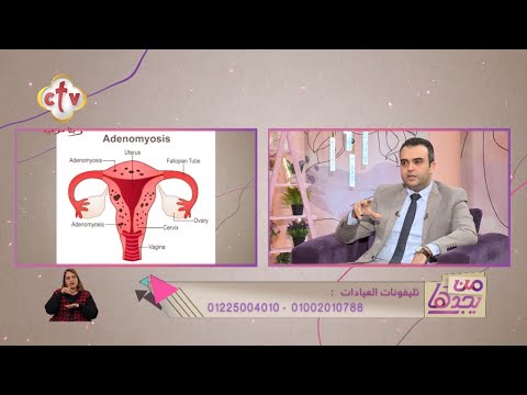 هذه هى أسباب النزيف الرحمي في غير موعد الدورة الشهرية برنامج من يجدها