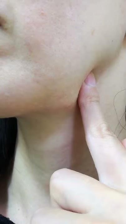 首のしこり Youtube