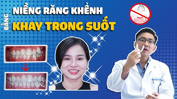 #Case 28: Niềng Răng Khểnh Cho Nữ Tiếp Viên Hàng Không | Khay Niềng Răng Trong Suốt Vinalign