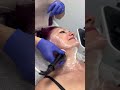UltraSculpt Facial — Founder Demonstration