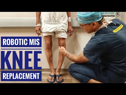 Patient Story — Bilateral Robotic Knee Replacement