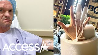 Neil Patrick Harris Recovering From Hand Surgery After This Bizarre Incident