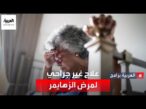 تقنية مبتكرة لعلاج غير جراحي لمرض ألزهايمر
