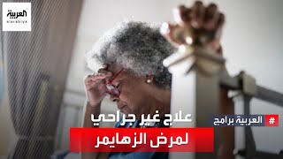 تقنية مبتكرة لعلاج غير جراحي لمرض ألزهايمر