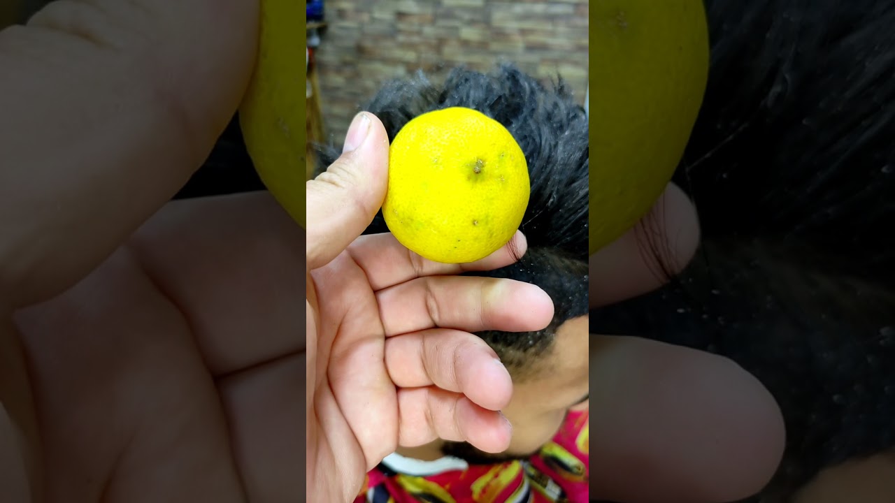 إزالة القشرة من فروة الرأس 👍 بطريقة سهلة وفعالة ومجربة 