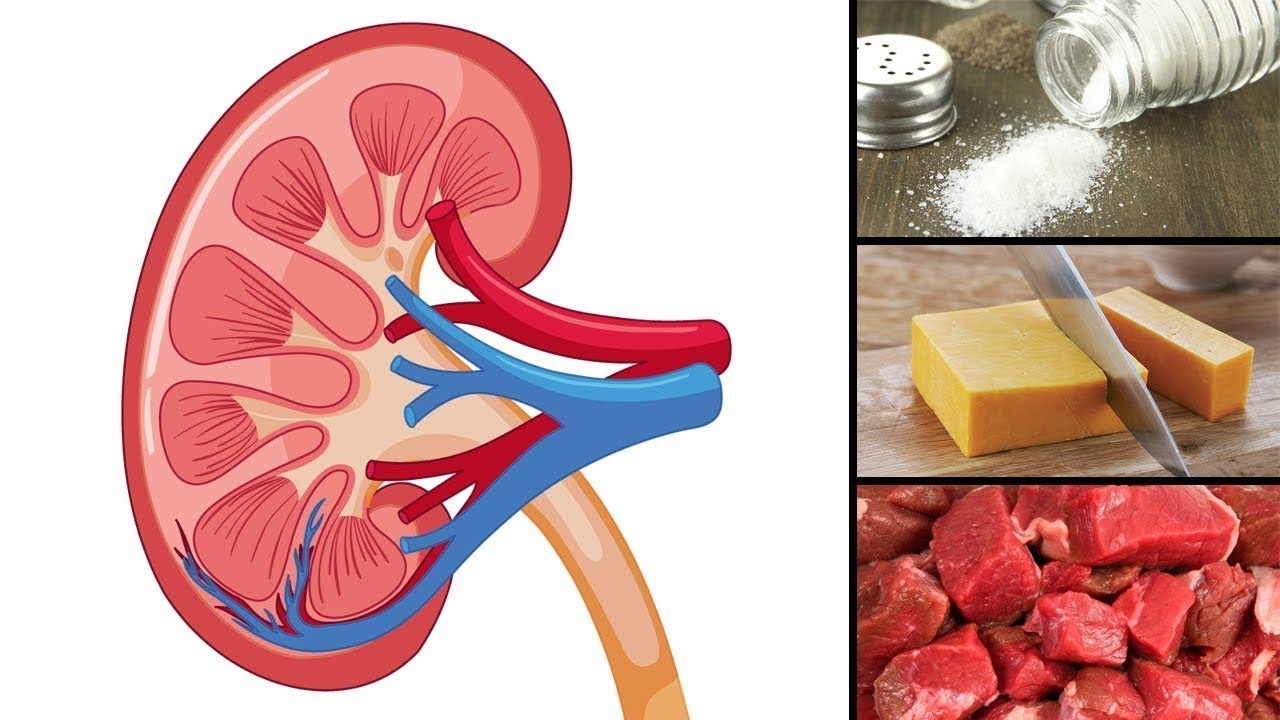 8 Foods That Are Actually Damaging Your Kidneys YouTube