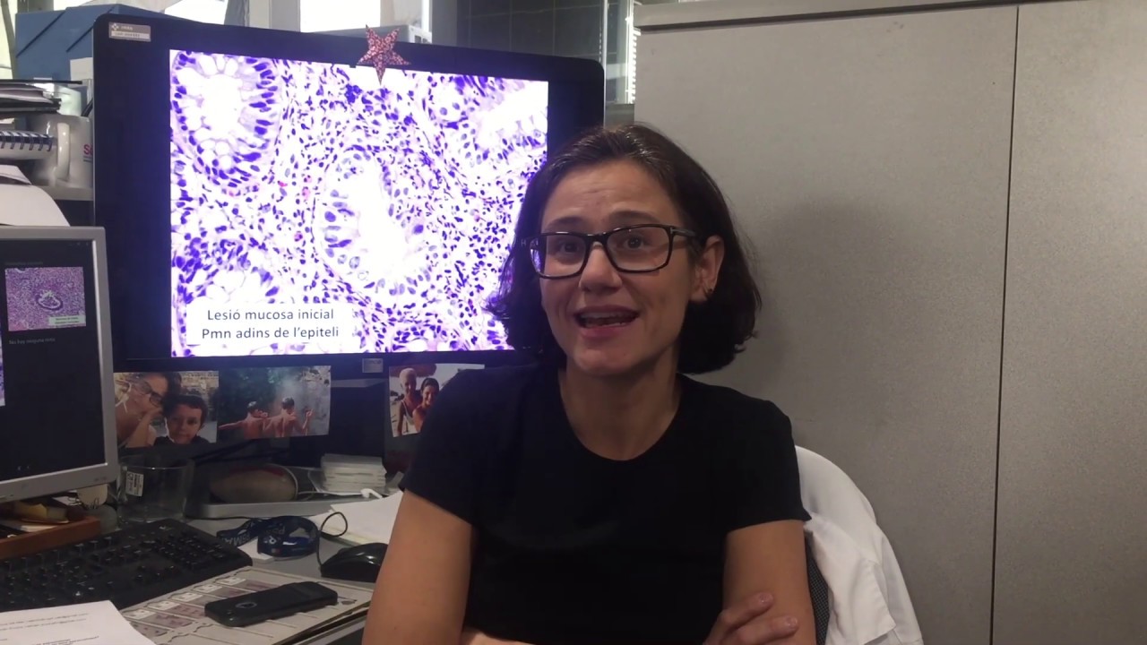 ANATOMÍA PATOLÓGICA: ENTREVISTA a una MÉDICA ADJUNTA | #MIRemAlFutur