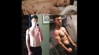 Natural Transformation Before and After Open Heart Surgery (Age 14-17) Chris Petrella