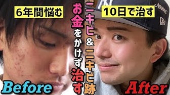 よこす Youtube よこす Youtube