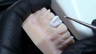 VITA LUMEX AC e VITA AMBRIA step by step  - Odt. Giuseppe Regano
