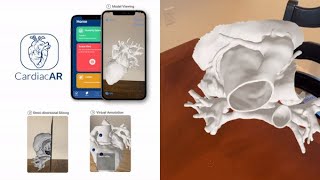 CardiacAR: Interactive Cardiovascular Surgical Planning via Augmented Reality