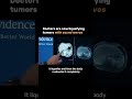 This ultrasound technique is destroying tumors in seconds #Medical #Science