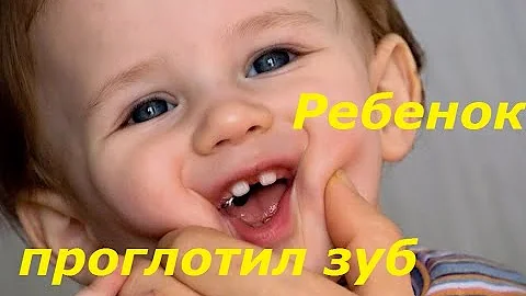 Ребенок проглотил молочный зуб. Насколько это опасно?