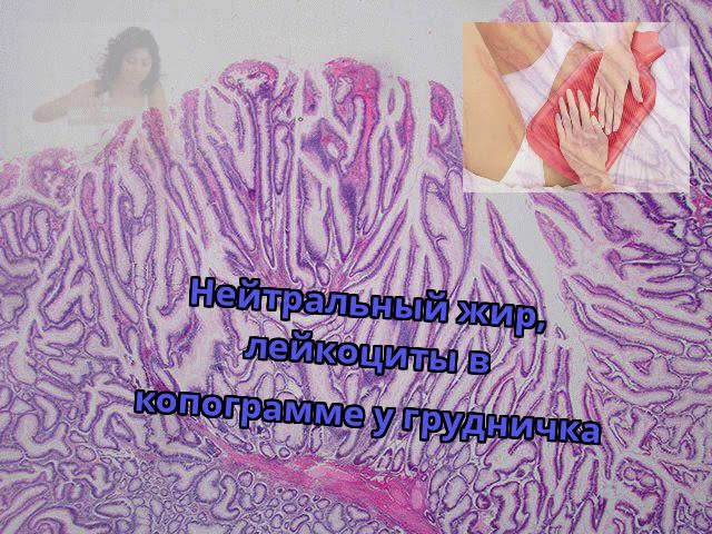 Нейтральный жир, лейкоциты в копограмме у грудничка