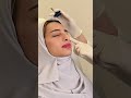 كيف تخلصت فرح من مظهر الارهاق
