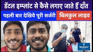 Complete Procedure of Dental implant | Best Teeth Implant Hospital in India | Implant By DR. Rajesh screenshot 5