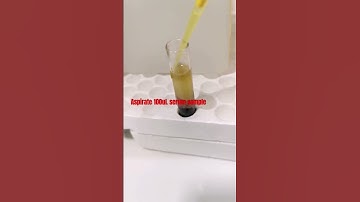 Hepa B Screening test #laboratory #medtechstudent #cls #mls #lab #serology #hepatitisb #hepab #blood