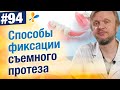 Какие бывают способы фиксации съемных протезов?