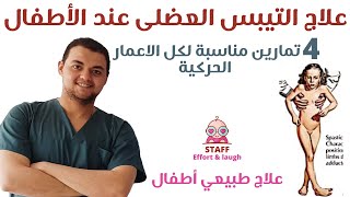 علاج التشنجات العضليه عند اطفال الشلل الدماغى | dessociation | علاج طبيعي للتيبس العضلى عند الاطفال