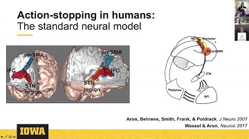 CCC Showcase 2021: Jan Wessel - A two-stage pause-then-cancel model of human action stopping