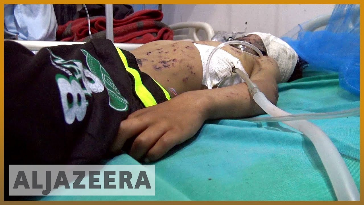🇾🇪 الأمم المتحدة تدعو إلى إجراء تحقيق في الهجوم على حافلة مدرسية في اليمن | الجزيرة الإنجليزية