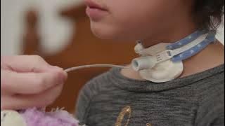 Open Suctioning with a Tracheostomy Tube at Home