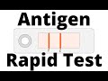 Understanding Antigen Rapid Tests
