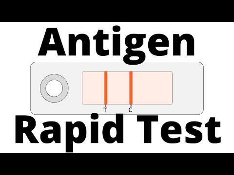 Video: Ar greitasis testavimas veikia?