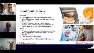 Multidisciplinary Perspectives on OSA Treatment with Inspire for CPAP intolerant Patients