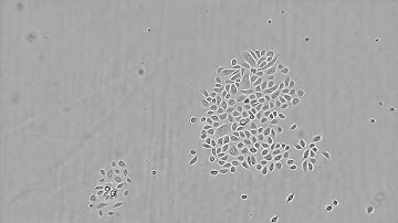 nHEK proliferation time lapse - CytoSMART Lux2