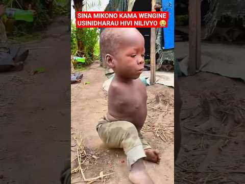 Wanavyo Nicheka Hivi Nilivyo Sina Mikono Kama Wao Inaniuma Mimi