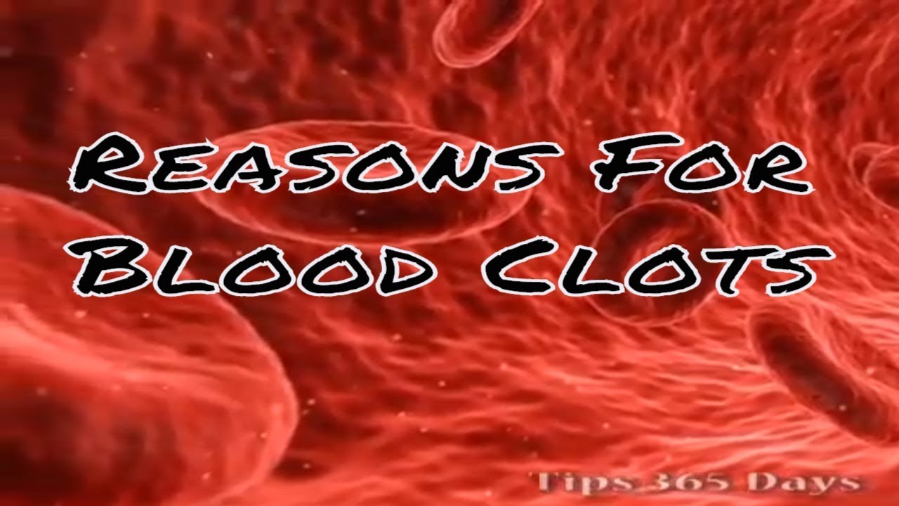 Reasons For Blood Clots,Cause Of Blood Clots,Facts About Blood Clots ...