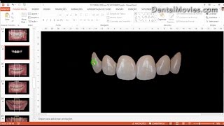 Digital Smile Design - Christian Coachman & Livio Yoshinaga - PART 4/4
