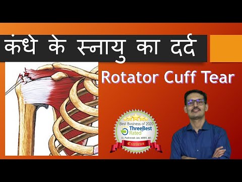 कंधे के स्नायु का दर्द Rotator Cuff Tear  hindi By Dr Prathmesh Jain Advance Hospitals Ahmedabad