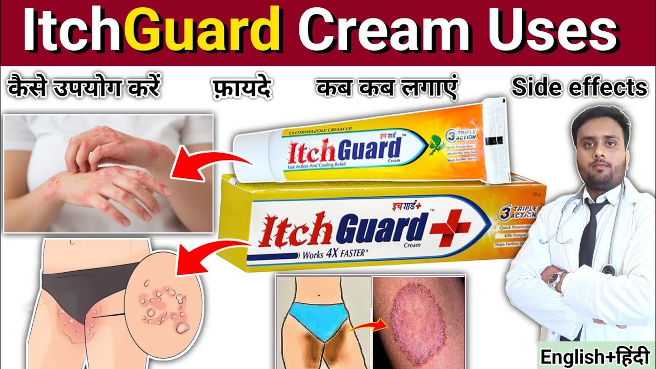 खुजली, दाद, खाज, ItchGuard Cream Uses | ItchGuard side effects | antifungal Cream , Ringworm Cream 