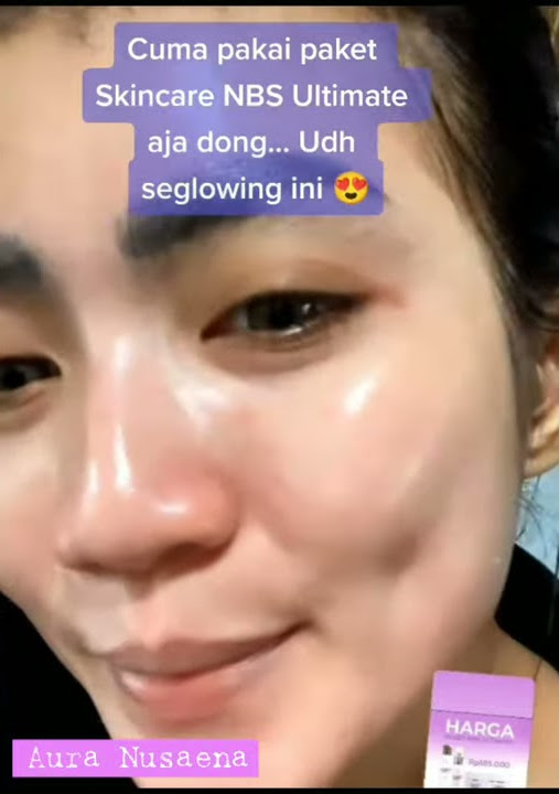 Testimoni Hasil Pemakaian Paket Ultimate by NBS Skincare